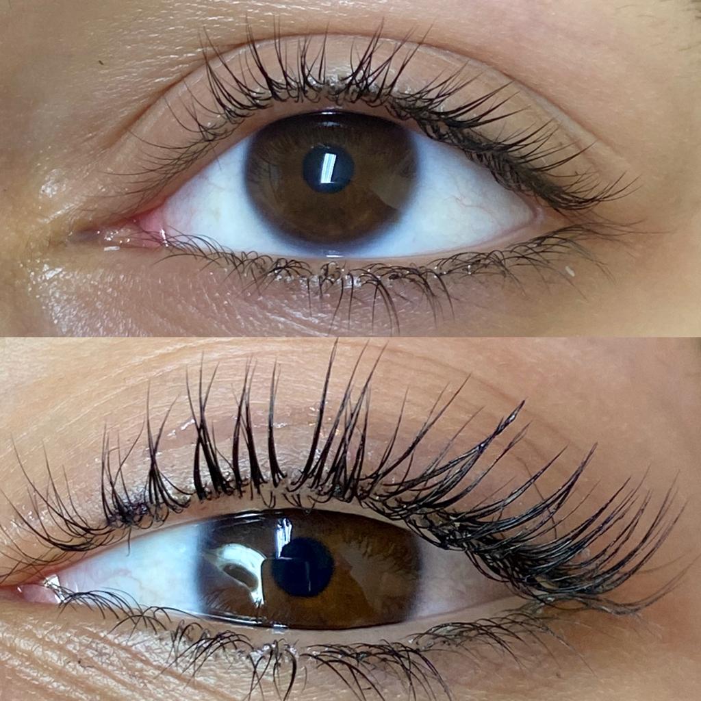 Botox ciglia
