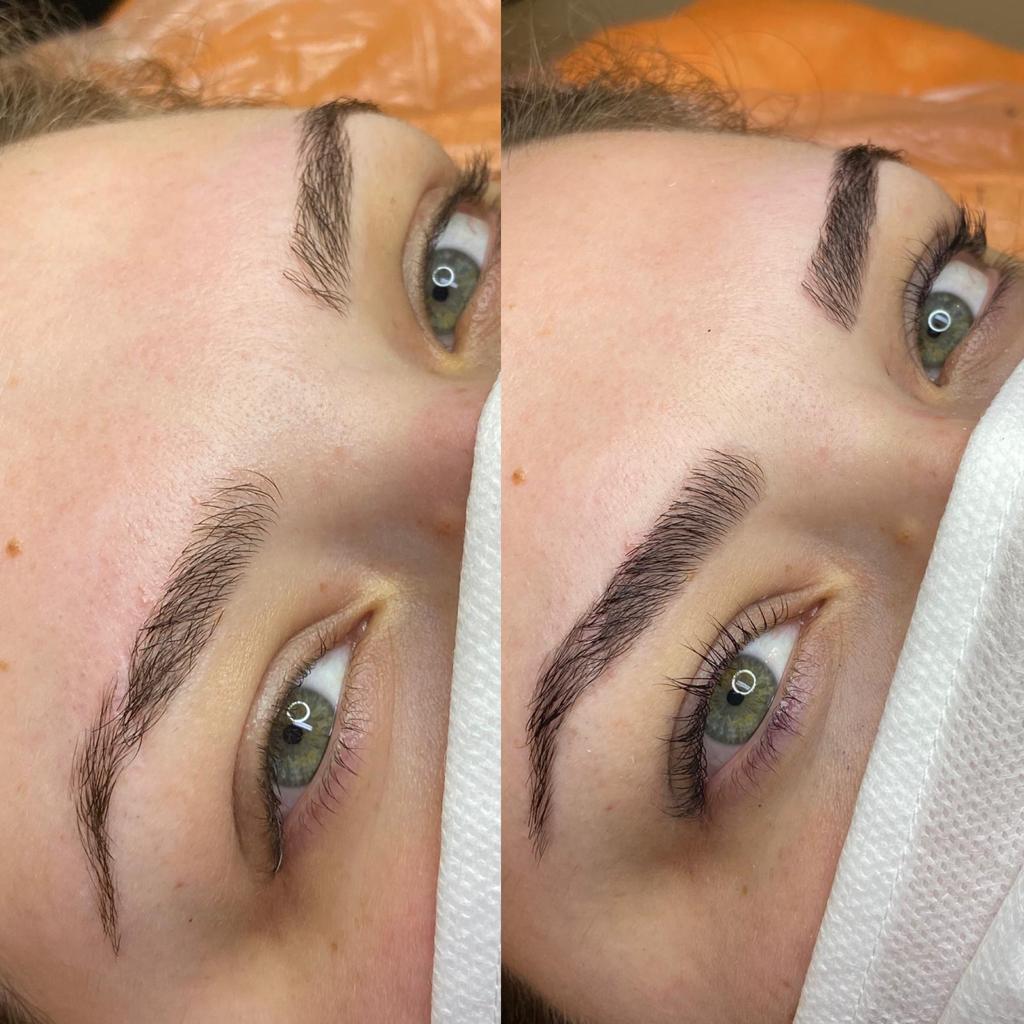 Botox ciglia